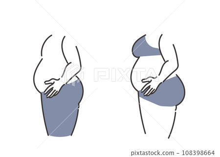 一個胖男人和一個女人的屍體側視圖的插圖 一個胖男人和一個女人的屍體側視圖的插圖 108398664