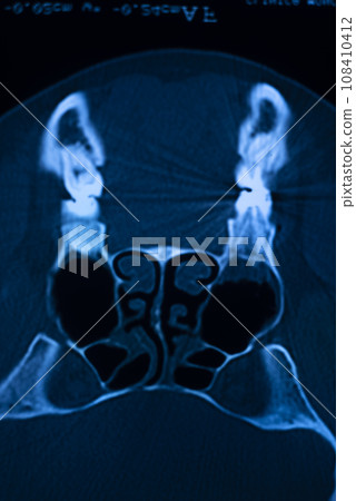 Xray scan skull nose Xray scan skull nose 108410412