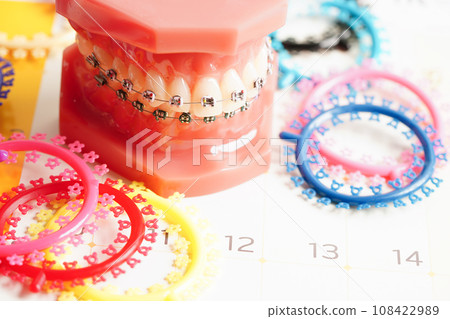 Orthodontic ligatures rings and ties, elastic rubber bands on orthodontic braces, model for dentist studying about dentistry. Orthodontic ligatures rings and ties, elastic rubber bands on orthodontic braces, model for dentist studying about dentistry. 108422989