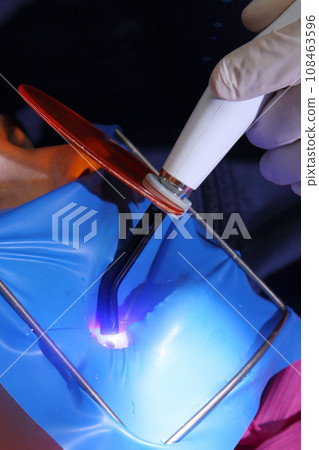 Dental office. Photo filling. Photo filling of a tooth. The dentist's workplace. Filling a tooth with ultraviolet light. Dental office. Photo filling. Photo filling of a tooth. The dentist's workplace. Filling a tooth with ultraviolet light. 108463596