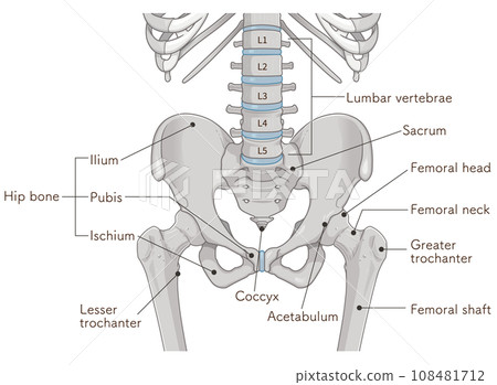 pelvis, pelvis, lumbar vertebrae, lumbar vertebrae, femur, femur, fracture, illustration 108481712