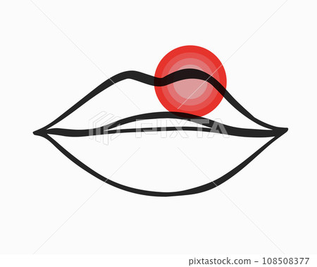 Vector isolated illustration of herpes on the lips. Infection with the herpes virus. Decreased immunity. 108508377