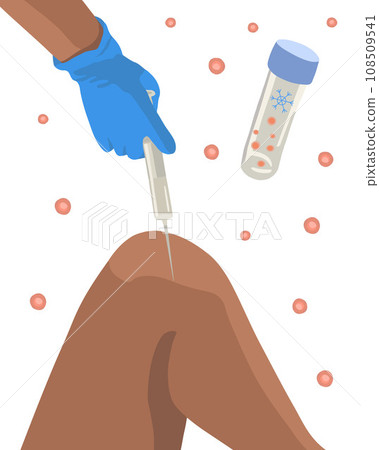 Vector isolated illustration of stem cell treatment. Stem cells in a test tube. Stem cells are injected into the knee. 108509541