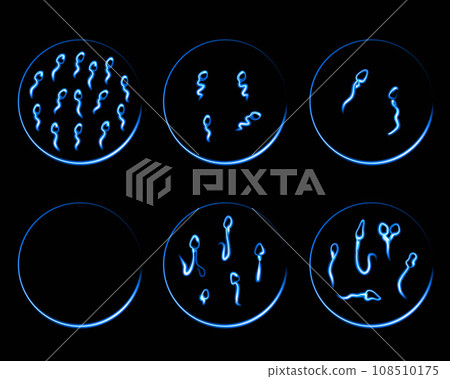 Vector isolated illustration of sperm pathologies. Spermogram. Sperm defects. Defects of the sperm head.  Sperm motility. 108510175