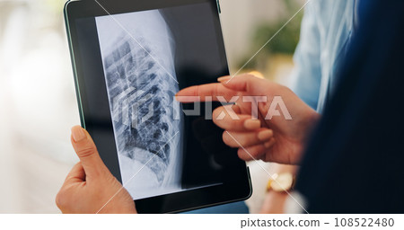 Healthcare, x ray and tablet for hand in closeup by pointing of injury on screen in consulting. Medical professional, doctor or person for technology of results, diagnosis or bone fracture of patient Healthcare, x ray and tablet for hand in closeup by pointing of injury on screen in consulting. Medical professional, doctor or person for technology of results, diagnosis or bone fracture of patient 108522480