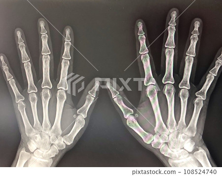 在醫院進行雙手X光檢查 108524740