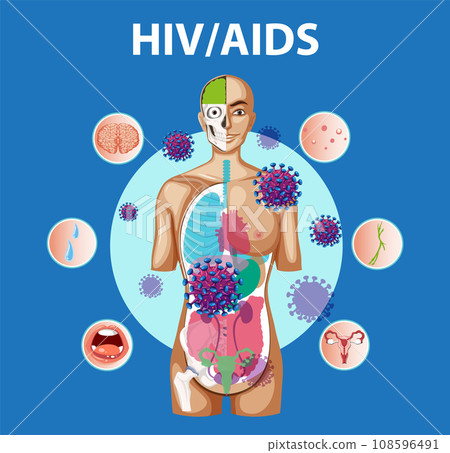 HIV/AIDS Virus: Effects on Immune System and Body 108596491