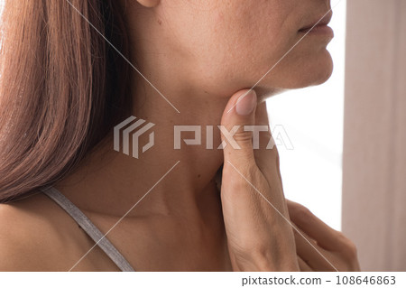 Cervical lymphadenitis of the right side in a woman 108646863