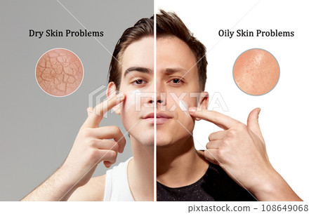 Dry skin vs oily ski problems. Young men with different skin types using cream for nutrition, moisturizing and healthy looking face Dry skin vs oily ski problems. Young men with different skin types using cream for nutrition, moisturizing and healthy looking face 108649068