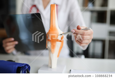 Doctor traumatologist examines x-ray and legs and the model of knee joint Doctor traumatologist examines x-ray and legs and the model of knee joint 108668234