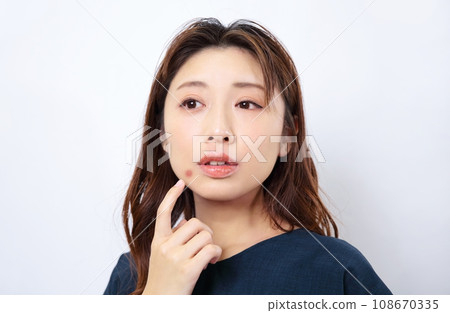 Image of a woman suffering from acne Image of a woman suffering from acne 108670335