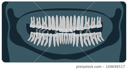 Panoramic dental X-Ray. 32 healthy tooth on x-ray. Vector illustration. 108698517
