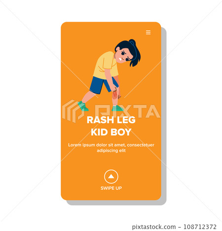 rash leg kid boy vector rash leg kid boy vector 108712372