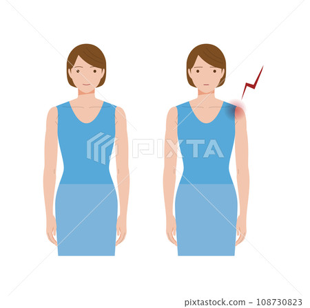 A woman suffering from shoulder pain due to frozen shoulder, frozen shoulder, frozen shoulder, and periarthritis. 108730823