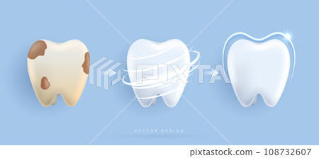 Set of dental cleaning and whitening teeth concept. comparison of clean and dirty tooth. dental health and oral hygiene poster for dentistry. examination teeth, whitening and repair. vector design. Set of dental cleaning and whitening teeth concept. comparison of clean and dirty tooth. dental health and oral hygiene poster for dentistry. examination teeth, whitening and repair. vector design. 108732607