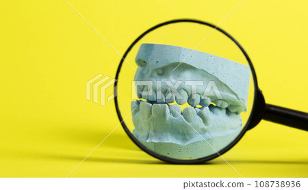 Medical plaster cast of a dental jaw with teeth on a yellow background under a magnifying glass. The concept of prosthetics and dental implantation in dentistry. Copy space for text Medical plaster cast of a dental jaw with teeth on a yellow background under a magnifying glass. The concept of prosthetics and dental implantation in dentistry. Copy space for text 108738936