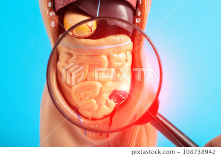 Mockup of a human with internal organs and red intestines under a magnifying glass on a blue background. Intestinal diseases concept, ulcerative colitis and intestinal ulcer, appendicitis. 108738942