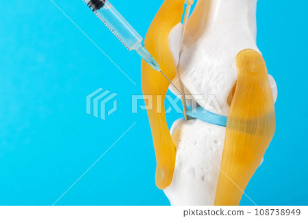 Intra-articular injection of anti-inflammatory medication into a mock-up knee joint on a blue background. The concept of drug blockade to relieve pain and inflammation. Copy space for text 108738949