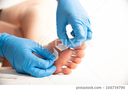A doctor covers calluses on a person s foot with a special plaster. Copy space for text, papilloma A doctor covers calluses on a person s foot with a special plaster. Copy space for text, papilloma 108739790