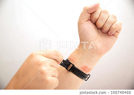 A man tightens a fitness bracelet with a silicone strap on his wrist, close-up. Concept of allergy and skin irritation from silicone watch strap, dermatitis. Copy space for text 108740488