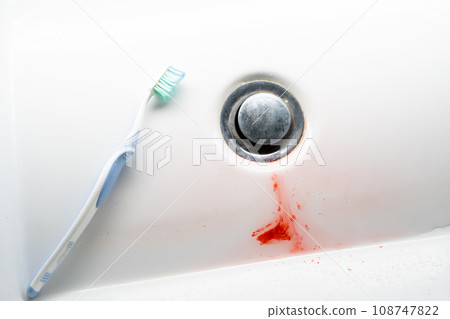 Toothbrush in a white washbasin with blood. Problem with gums 108747822