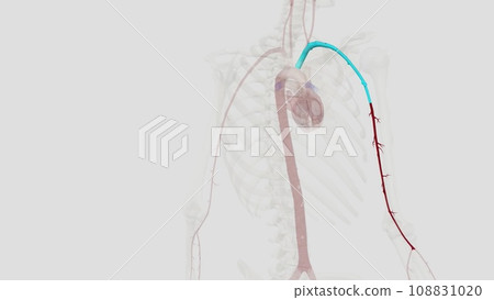 The brachial artery is the major blood vessel supplying blood to your arms The brachial artery is the major blood vessel supplying blood to your arms 108831020