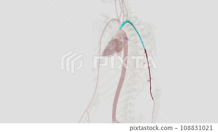 The brachial artery is the major blood vessel supplying blood to your arms The brachial artery is the major blood vessel supplying blood to your arms 108831021
