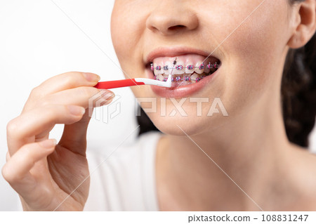 Close up of young Caucasian woman with brackets on teeth cleaning interdental space using orthodontic toothbrushes. White background. Concept of dental care during orthodontic treatment Close up of young Caucasian woman with brackets on teeth cleaning interdental space using orthodontic toothbrushes. White background. Concept of dental care during orthodontic treatment 108831247