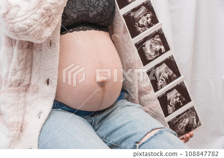 [孕婦影像迴音照片] 108847782