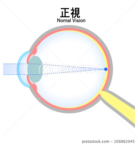 Illustration of normal eyeball (emmetropia) 108862045