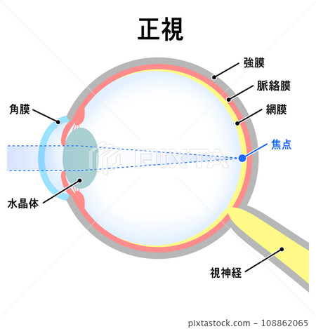 Illustration of normal eyeball (emmetropia) Illustration of normal eyeball (emmetropia) 108862065