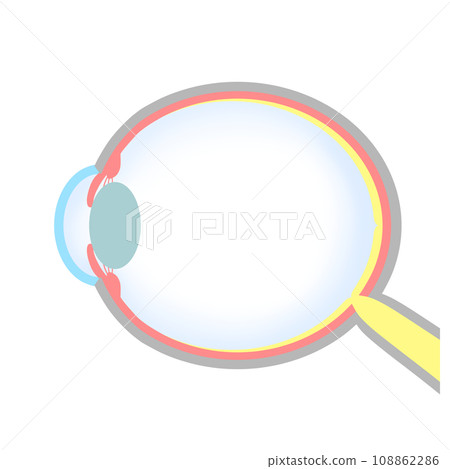 Illustration of an eyeball with axial myopia 108862286