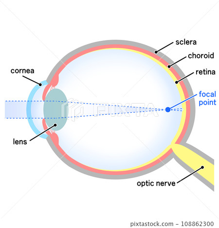 軸性近視眼球的插圖 108862300