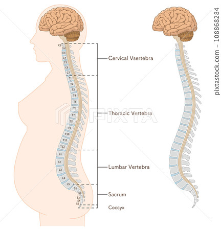 Illustration of painless childbirth, epidural anesthesia, subarachnoid anesthesia, spine, vertebral column, cervical vertebrae, thoracic vertebrae, lumbar vertebrae, sacrum, lateral orientation 108868284