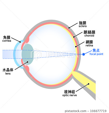 Illustration of an eyeball with axial hyperopia Illustration of an eyeball with axial hyperopia 108877719