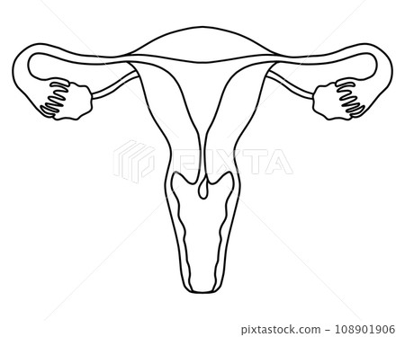 子宮內膜息肉與子宮頸息肉圖解 108901906