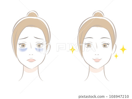 Dark circles before and after Dark circles before and after 108947210