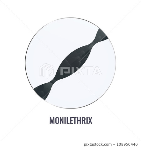 Monilethrix hair brittle disorder in close up 108950440