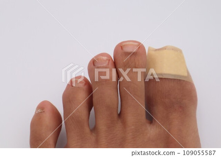 腳趾上纏著繃帶 109055587