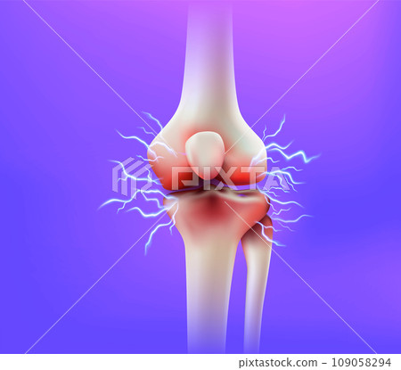 Knee joint pain and tendon problems 109058294