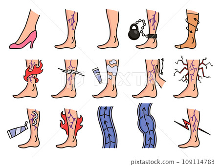 Varicose treatment icons set. Violation of circulatory system. Vascular disease diagnostic. Venous insufficiency medical disease. Vector illustration 109114783
