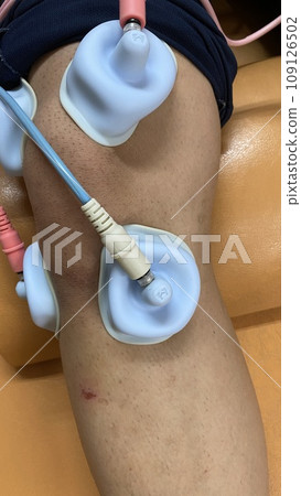 A man receiving interference waves at an osteopathic clinic A man receiving interference waves at an osteopathic clinic 109126502