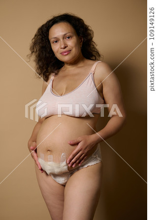 Smiling young mother shows at camera her postnatal belly with postpartum scar few days after after C-section cesarean Smiling young mother shows at camera her postnatal belly with postpartum scar few days after after C-section cesarean 109149126