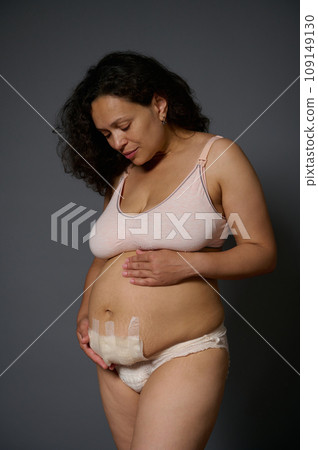 Authentic woman, new mother touching her belly with a bandage hiding scars after c-section, few days after childbirth 109149130