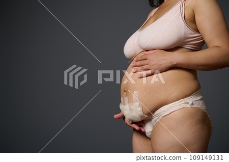 Close-up naked postpartum belly with bandage after cesarean C-section of a body positive woman mother, isolated on gray 109149131