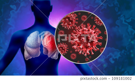 Pneumonia Outbreak Pneumonia Outbreak 109181002