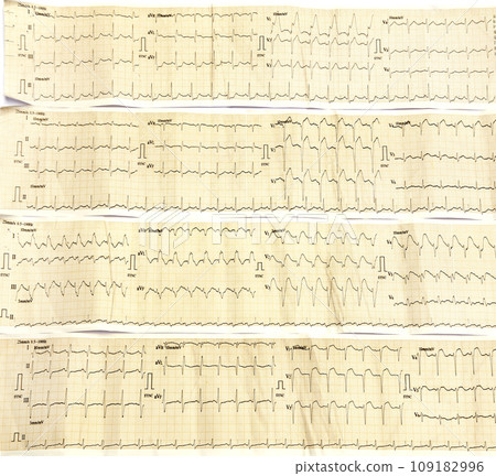 Electrocardiograph 109182996