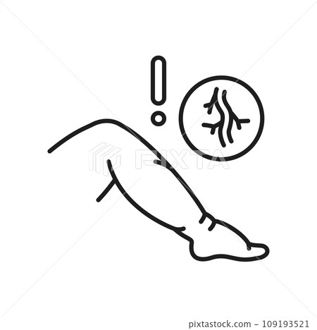 Varicose vein, venous disease edema line icon. Vascular mesh on legs. Vector icon venous edema, hypoproteinemia treatment disease 109193521