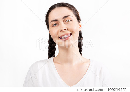 Portrait of smiling Caucasian young woman with ligature braces on her teeth. White background. Concept of orthodontic treatment and dentistry Portrait of smiling Caucasian young woman with ligature braces on her teeth. White background. Concept of orthodontic treatment and dentistry 109214351