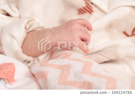 【剛出生的嬰兒皮膚脫落】 109224788